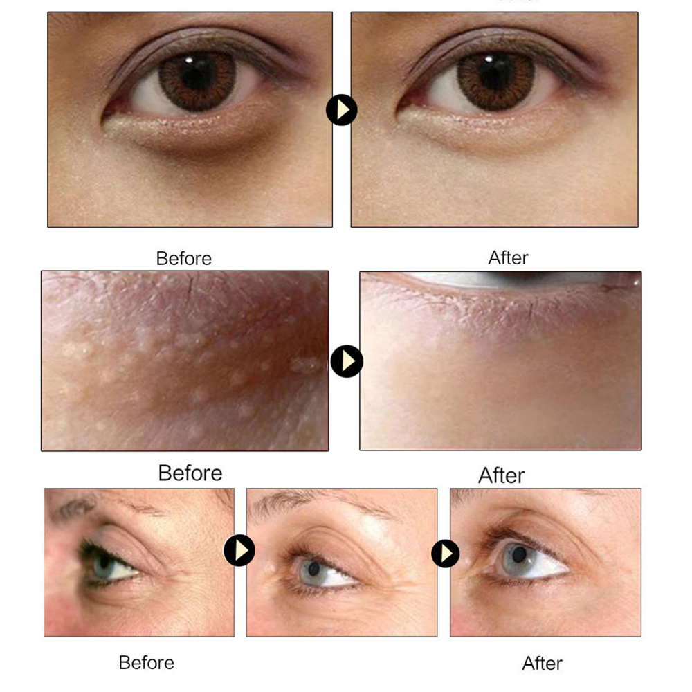 Collagen Eye Mask