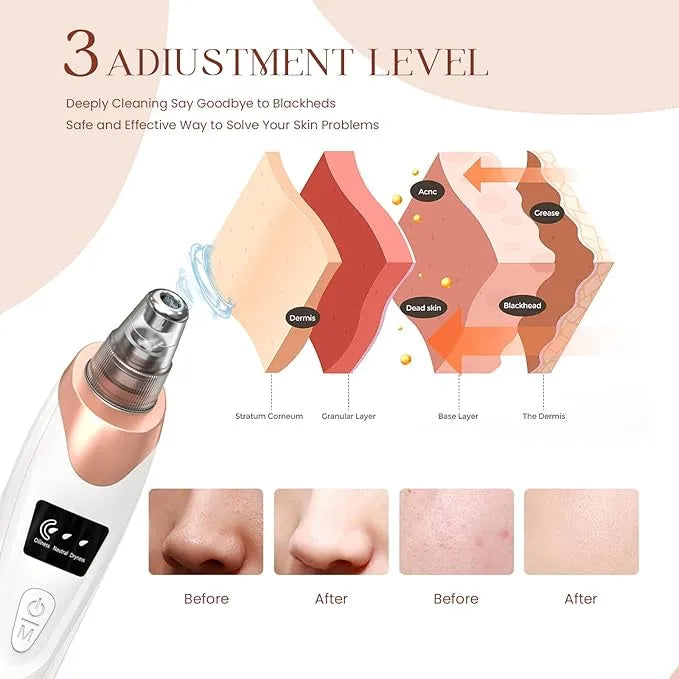 Auralis™ Pore Purifying Vacuum