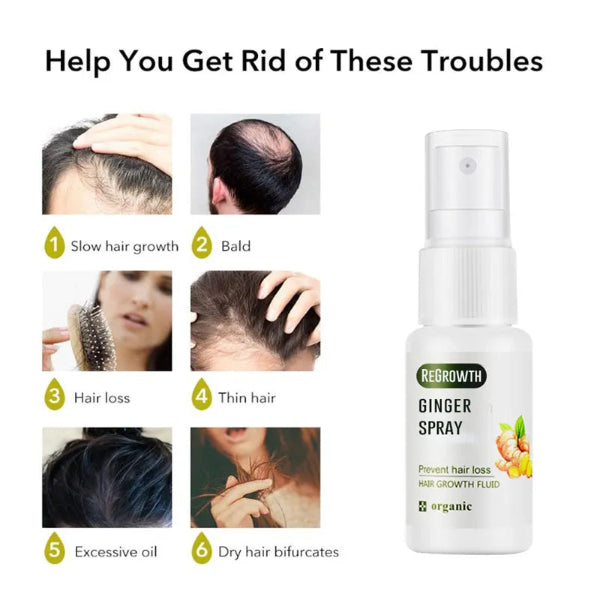 Auralis™ Ginger Scalp Tonic (3-Pack)