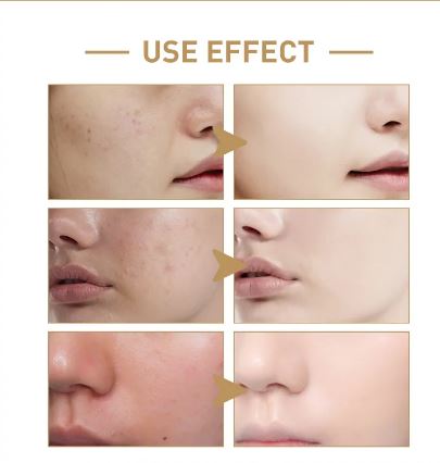 Auralis™  Rice Face Toner