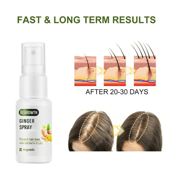 Regrowth Ginger Spray bottle with before and after hair growth illustrations on a white background